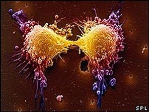 Tuer les cellules tumorales une mauvaise idée
